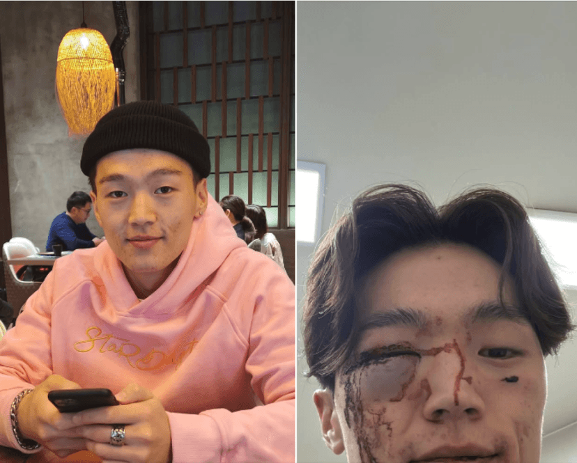 Таванбогдын Баатарсайханы хүү Б.Амарсайханы турхилалтаар бүлэг залууст зодуулсан хүүгийн аав хэвлэлд хандлаа